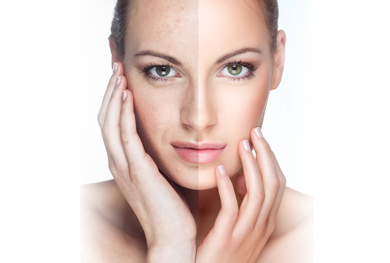 Выравнивание поверхности кожи лица
